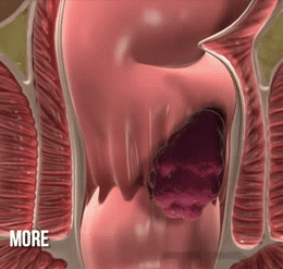 1763995143318126.gif 1763995143318126.gif